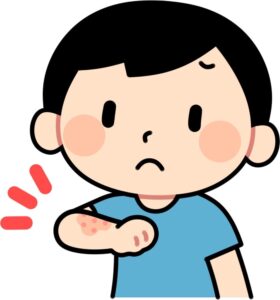 腕に湿疹のある男の子