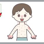 川崎病