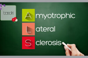 ALS