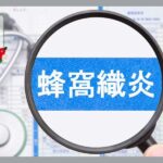 蜂窩織炎