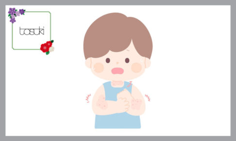 湿疹の出ている男の子