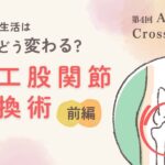 手術で生活はどう変わる?人工股関節置換術前編というテキストと股関節のイラスト
