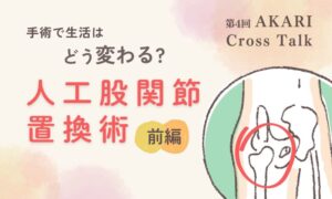 手術で生活はどう変わる？人工股関節置換術前編というテキストと股関節のイラスト