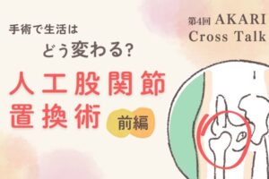 手術で生活はどう変わる？人工股関節置換術前編というテキストと股関節のイラスト